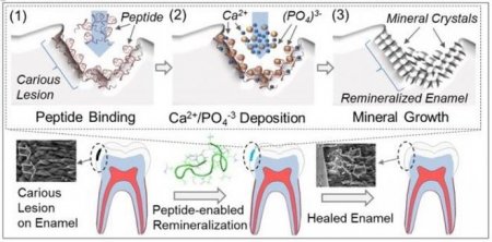 Зубная паста с пептидами способна пломбировать дыры в зубах