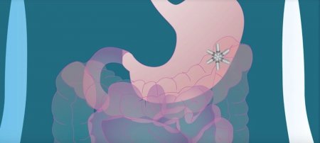 Мультидозовая капсула с лекарством прошла первые испытания на людях