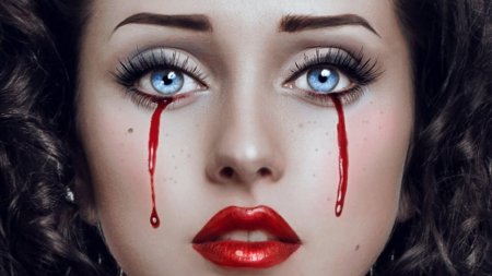 Из-за чего у человека может идти кровь из глаз?