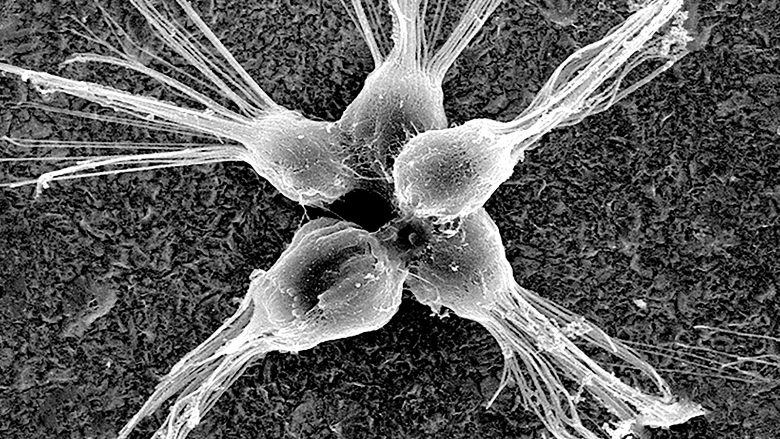 Известные организма. Monosiga brevicollis. Хоанофлагелляты. Choanoflagellata строение. Отряд воротничковые жгутиконосцы (Choanoflagellida)..